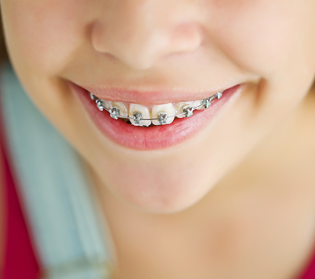 Bayport Phase Two Orthodontics